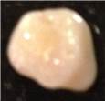 Tooth0228.JPG