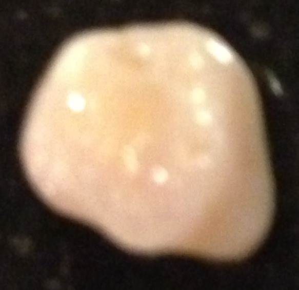Tooth0228.JPG
